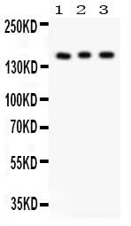 Anti-Insulin Receptor/INSR Antibody Picoband® Boster Bio