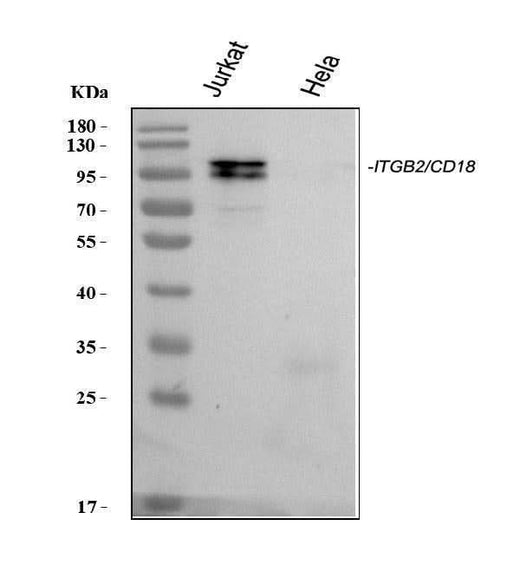 Anti-CD18/ITGB2 Antibody Picoband® Boster Bio