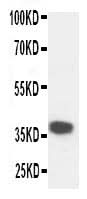 Anti-Kallikrein 5/KLK5 Antibody Picoband® Boster Bio