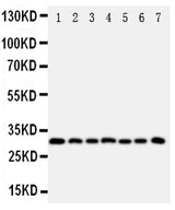 Anti-Kallikrein 11/KLK11 Antibody Picoband® Boster Bio