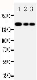 Anti-MRP1/ABCC1 Antibody Picoband® Boster Bio