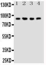 Anti-NRG2 Antibody Picoband® Boster Bio