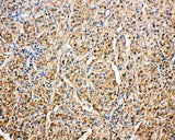 Anti-Kallistatin/SERPINA4 Antibody Picoband® Boster Bio