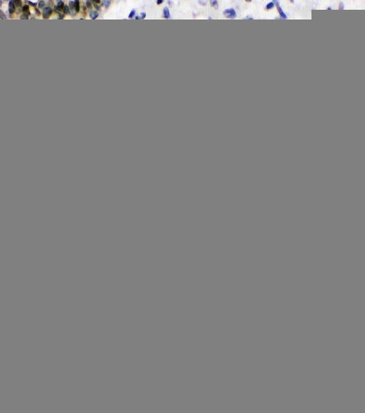 Anti-XRCC1 Antibody Picoband® Boster Bio