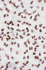 Anti-Ku70/XRCC6 Antibody Picoband® Boster Bio