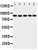 Anti-5 Lipoxygenase/ALOX5 Antibody Picoband® Boster Bio