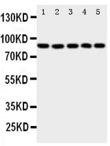 Anti-5 Lipoxygenase/ALOX5 Antibody Picoband® Boster Bio