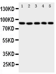Anti-5 Lipoxygenase/ALOX5 Antibody Picoband® Boster Bio