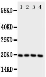 Anti-Lipocalin-1 LCN1 Antibody Picoband® Boster Bio