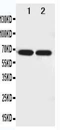 Anti-Netrin 1/NTN1 Antibody Picoband® Boster Bio