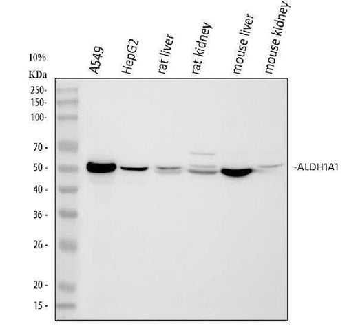 Anti-Retinal dehydrogenase 1 ALDH1A1 Antibody Picoband® Boster Bio