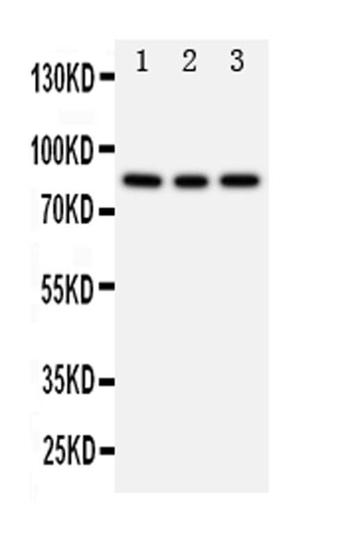 Anti-PI 3 Kinase p85 beta/PIK3R2 Antibody Picoband® Boster Bio