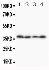 Anti-Stra8 Antibody Picoband® Boster Bio
