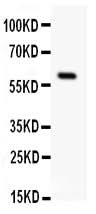 Anti-Somatostatin Receptor 1/SSTR1 Antibody Picoband® Boster Bio