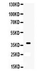Anti-DNA repair protein XRCC3 XRCC3 Antibody Picoband® Boster Bio