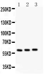 Anti-CYP11A1 Antibody Picoband® Boster Bio