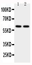 Anti-CYP11A1 Antibody Picoband® Boster Bio