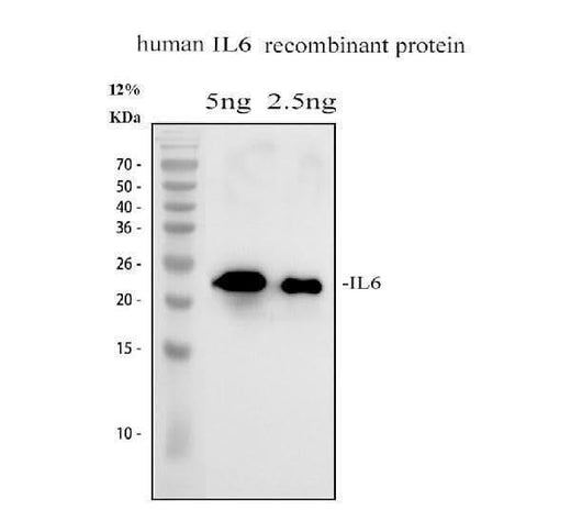 Anti-Interleukin-6 IL6 Antibody Picoband® Boster Bio