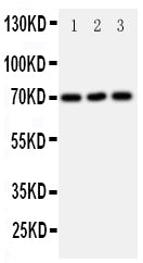 Anti-Serotonin transporter/SLC6A4 Antibody Picoband® Boster Bio