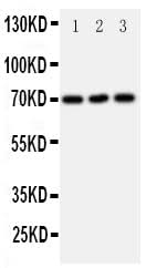 Anti-Serotonin transporter/SLC6A4 Antibody Picoband® Boster Bio