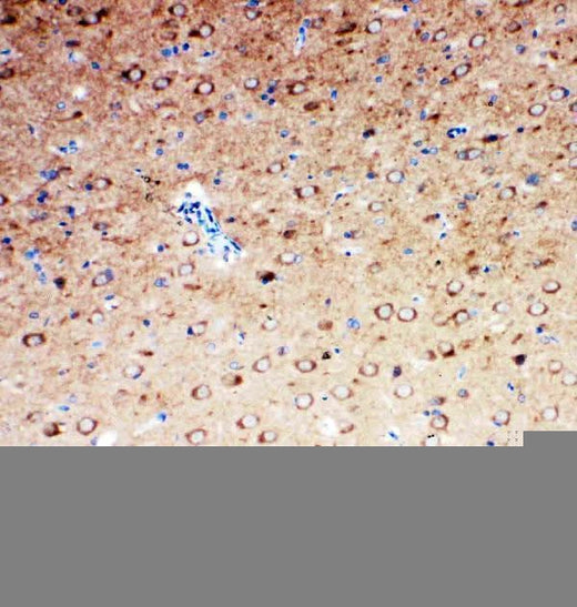 Anti-Serotonin transporter/SLC6A4 Antibody Picoband® Boster Bio