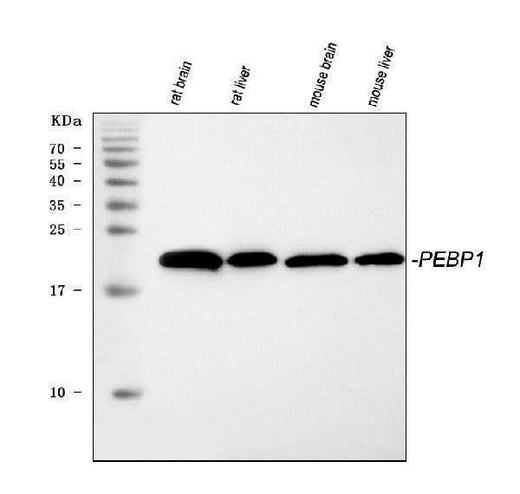 Anti-PBP/PEBP1 Antibody Picoband® Boster Bio
