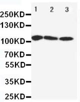 Anti-SERCA1 ATPase/ATP2A1 Antibody Picoband® Boster Bio