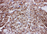 Anti-Glucose Transporter GLUT4/SLC2A4 Antibody Picoband® Boster Bio