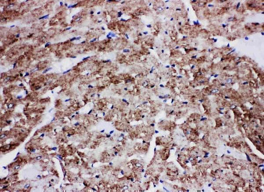 Anti-Glucose Transporter GLUT4/SLC2A4 Antibody Picoband® Boster Bio