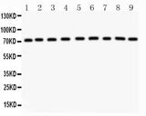 Anti-Growth hormone receptor/GHR Antibody Picoband® Boster Bio