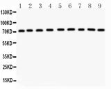 Anti-Growth hormone receptor/GHR Antibody Picoband® Boster Bio