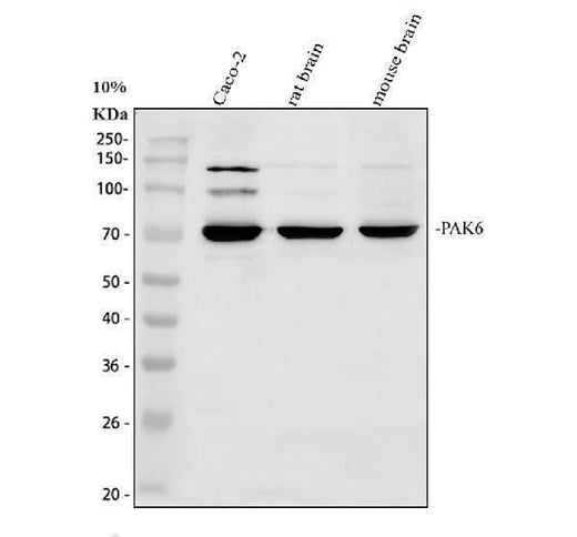 Anti-PAK6 Antibody Picoband® Boster Bio