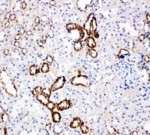 Anti-Glucose Transporter 5 GLUT5/SLC2A5 Antibody Picoband® Boster Bio