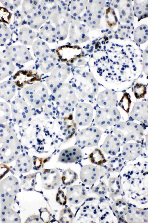 Anti-Aquaporin 2/AQP2 Antibody Picoband® Boster Bio