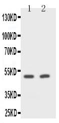 Anti-CD2/CD2 Antibody Picoband® Boster Bio