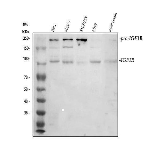 Anti-IGF1 Receptor/IGF1R Antibody Picoband® Boster Bio