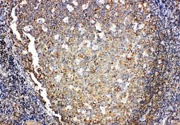 Anti-Interleukin-4 IL4 Antibody Picoband® Boster Bio
