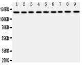 Anti-TRPC3 Antibody Picoband® Boster Bio