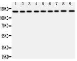Anti-TRPC3 Antibody Picoband® Boster Bio