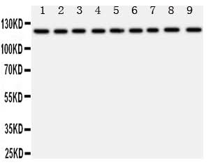 Anti-TRPC3 Antibody Picoband® Boster Bio