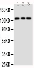 Anti-TRPC6 Antibody Picoband® Boster Bio