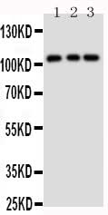 Anti-TRPC6 Antibody Picoband® Boster Bio