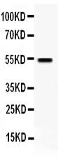 Anti-VIP Receptor 1/VIPR1 Antibody Picoband® Boster Bio