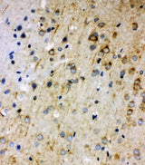 Anti-Rab5/RAB5A Antibody Picoband® Boster Bio