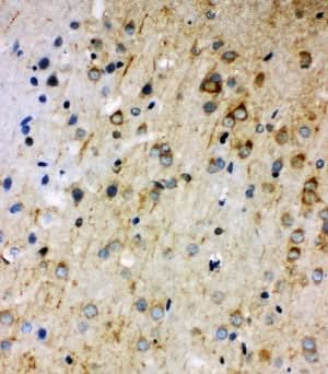 Anti-Rab5/RAB5A Antibody Picoband® Boster Bio