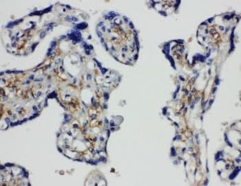 Anti-SNAP23 Antibody Picoband® Boster Bio