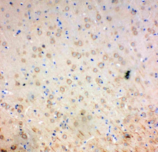 Anti-SOD2 Antibody Picoband® Boster Bio