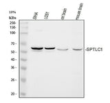 Anti-Serine palmitoyltransferase 1 SPTLC1 Antibody Picoband® Boster Bio