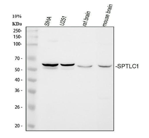 Anti-Serine palmitoyltransferase 1 SPTLC1 Antibody Picoband® Boster Bio