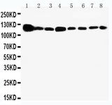 Anti-Vinculin/VCL Antibody Picoband® Boster Bio